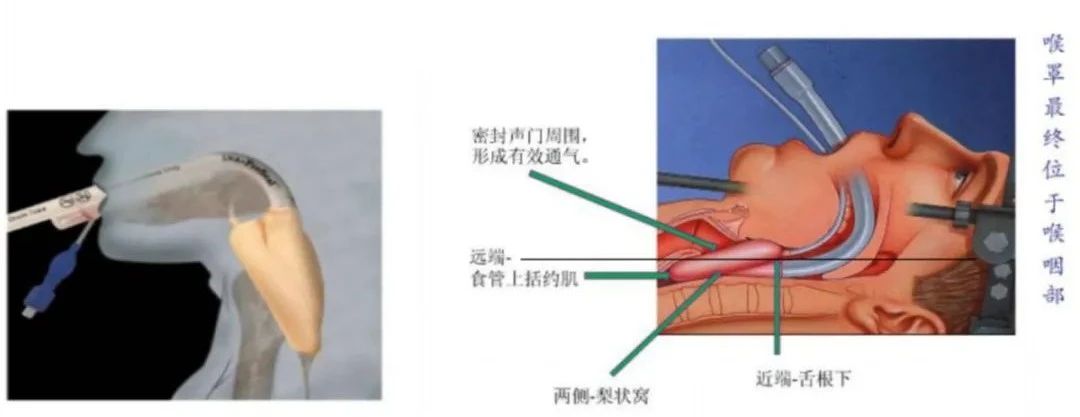 海盐康源医疗器械有限公司